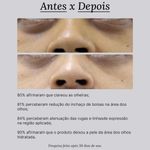7898965429461-Creme-Para-Area-dos-Olhos-Creamy-Eye-Cream-Anti-Idade-15g--3-
