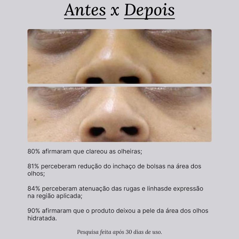 7898965429461-Creme-Para-Area-dos-Olhos-Creamy-Eye-Cream-Anti-Idade-15g--3-