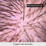 3474637090579_4-Creme-de-Tratamento-Calmante-Loreal-Scalp-Advanced